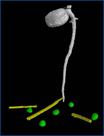 N FORM ROOT